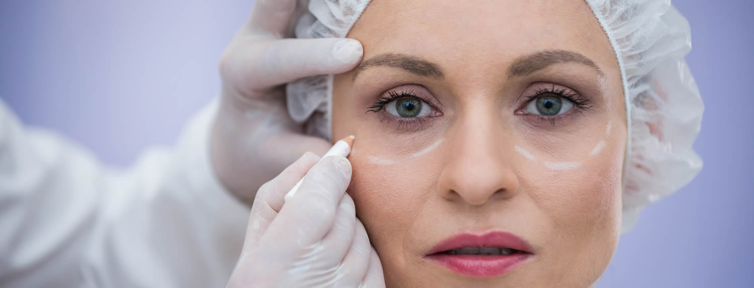 Blefaroplastia