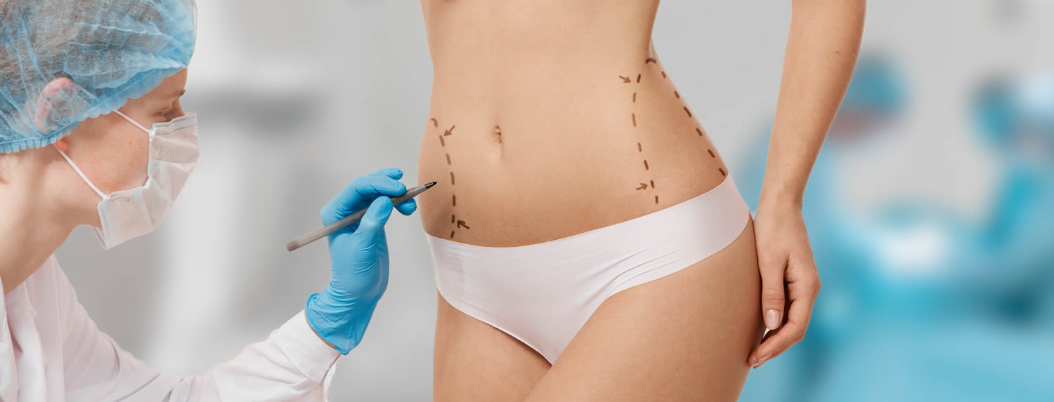 Lipoescultura
