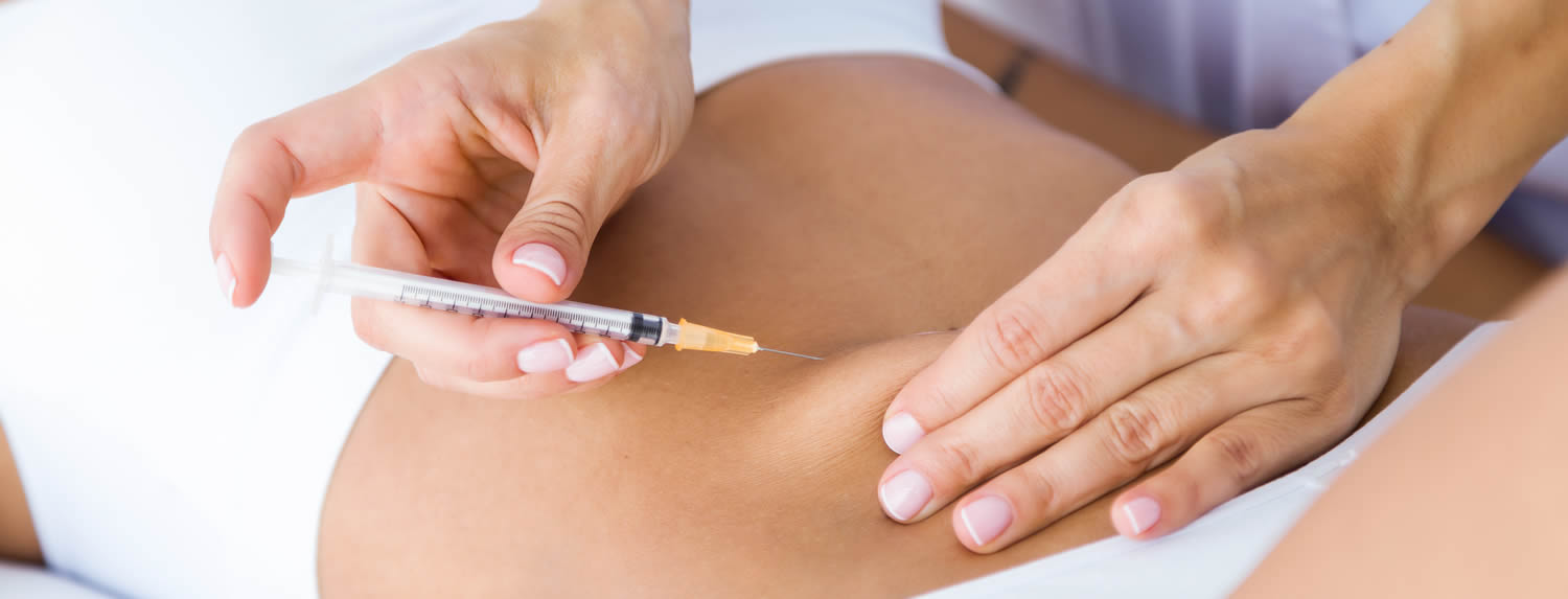 Radiofrecuencia y Carboxiterapia