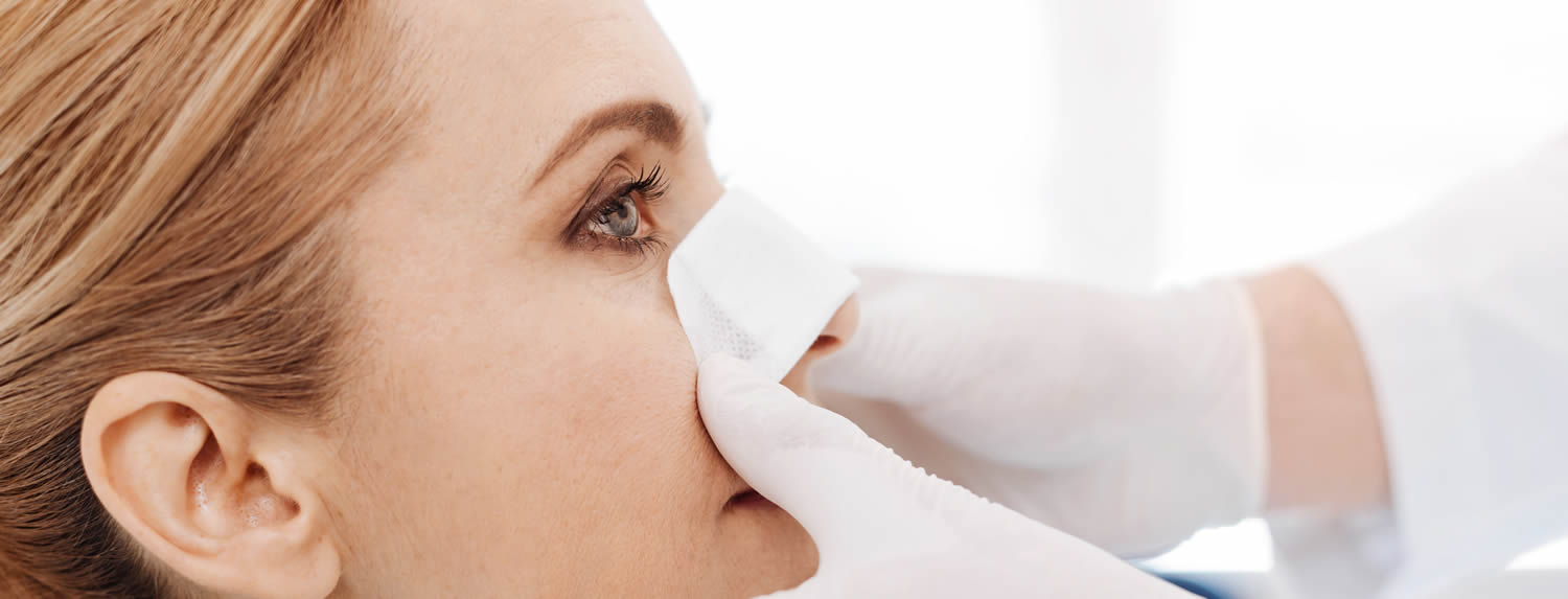 Rinoplastia