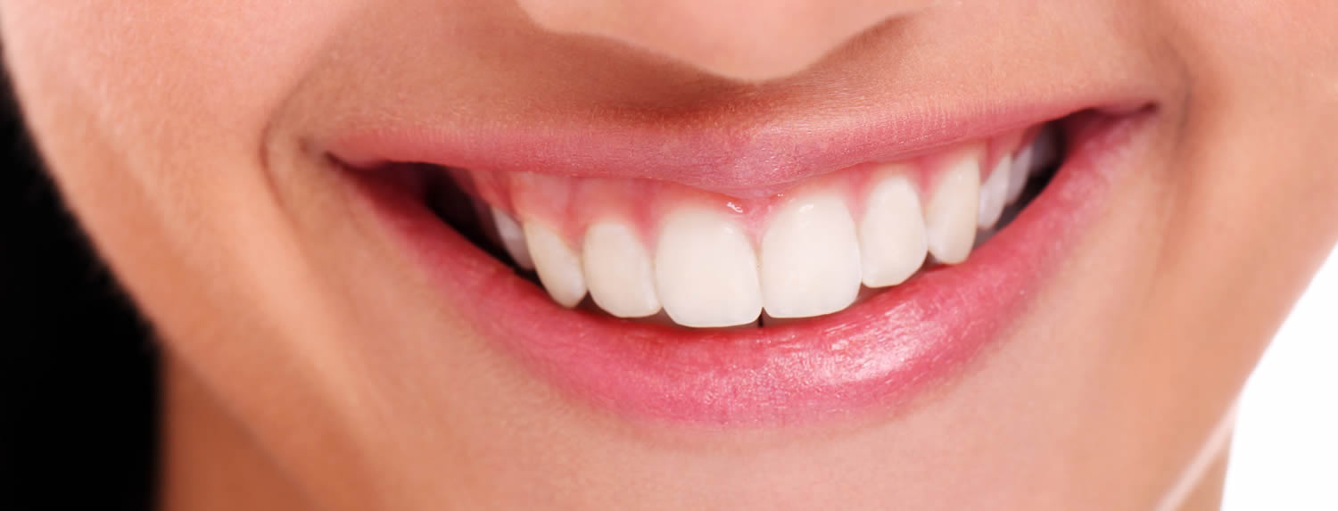 Sonrisa Gingival