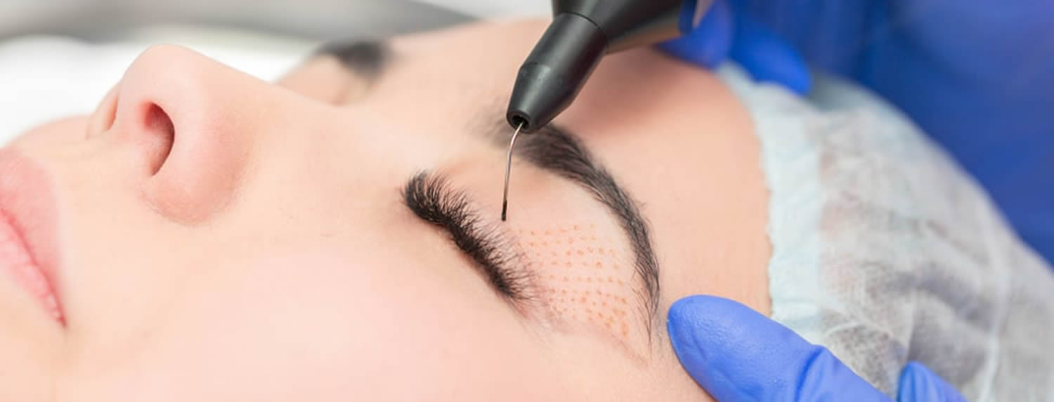 Plasma Laser o HANDY® Plasma