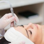 Conoces qué es el Plasma Láser